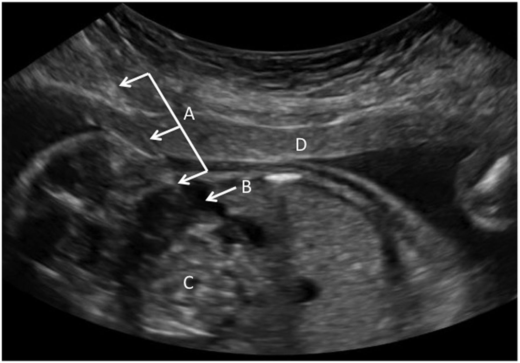 intrauterine-procedures-dr-aarti-govardhane